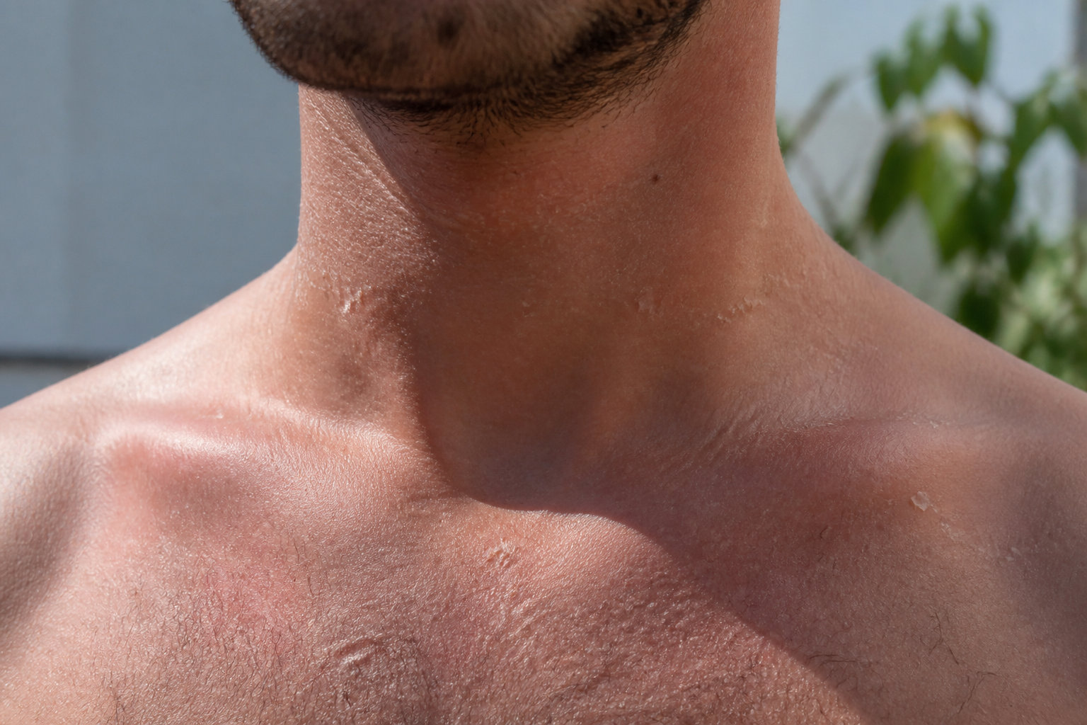 3 signes physiques pour identifier une urgence thermique
